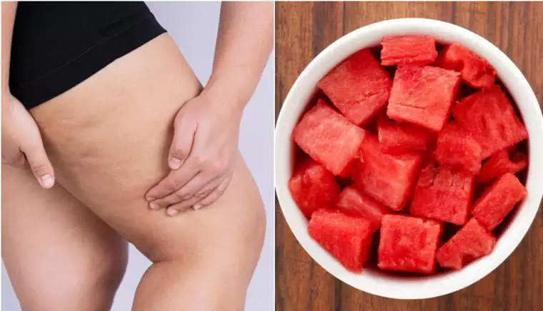 retencao-e1724117845962